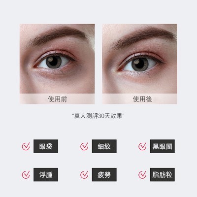 MARASIL - 射頻眼部導入美容儀 (去細紋皺紋黑眼圈 提拉緊緻)